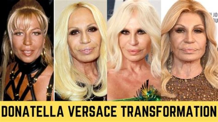 What happened to Donatella Versace’s face? Dramatic transformation through several plastic surgeries